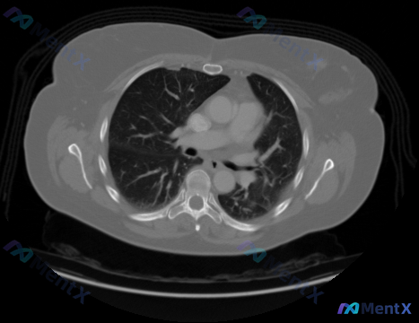 Post 212 image 1