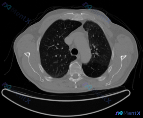 Post 110 image 1