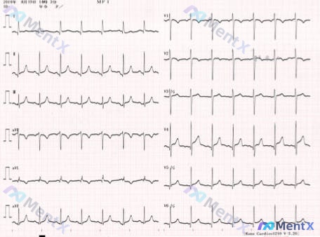 Post 2056 image 1