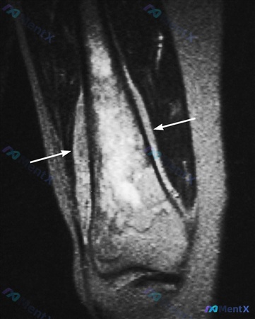 Post 2060 image 2