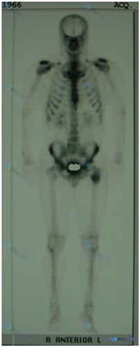 Post 1912 image 3