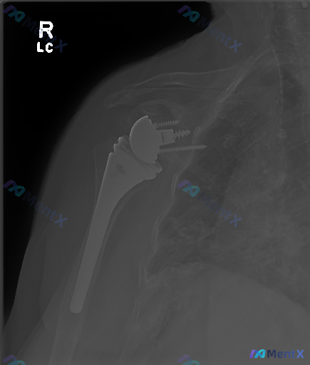 Post 3151 image 1
