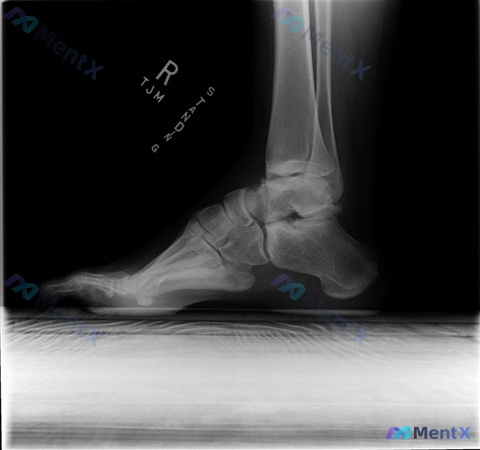 Post Image 4