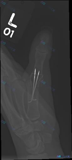 Post Image 1