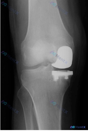 Post 132 image 1