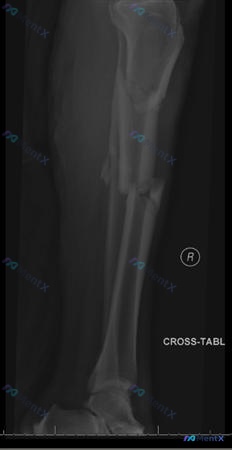 Post 528 image 2