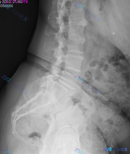 Post 2802 image 2