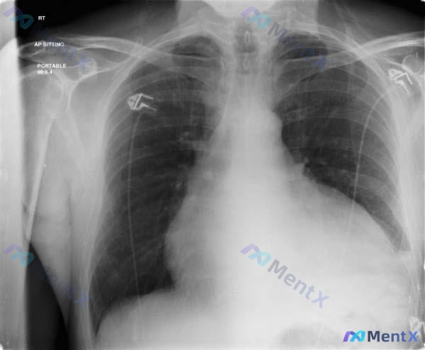 Post 1614 image 1