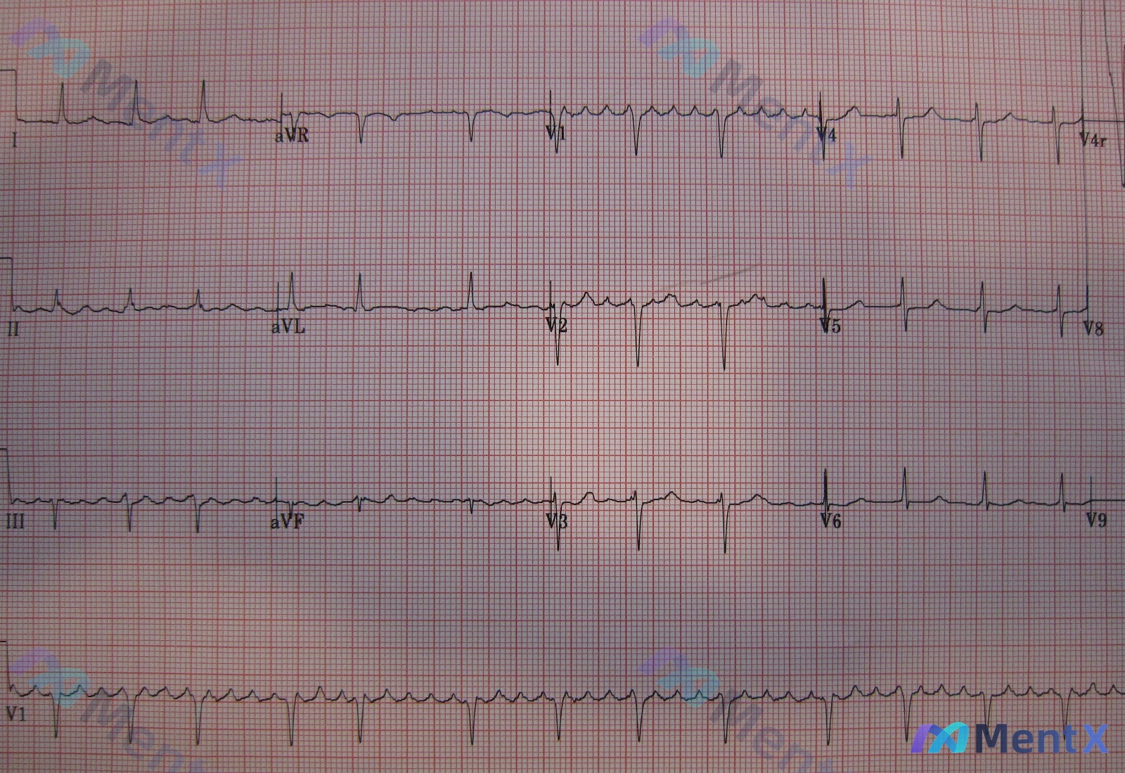 Post 2072 image 1