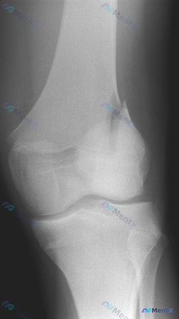 Post 162 image 1