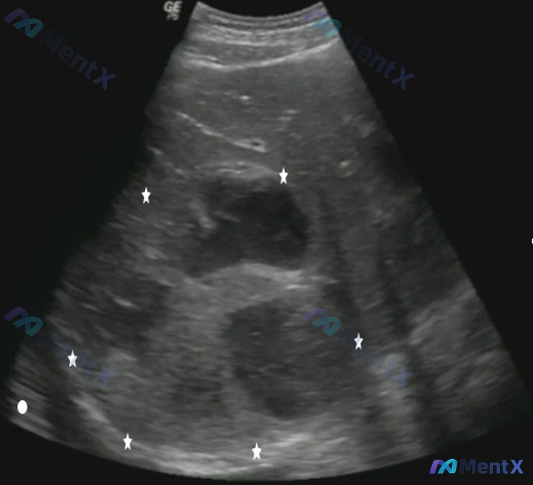 Post 60 image 1
