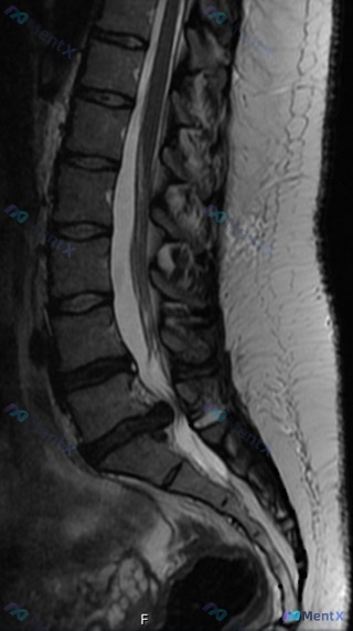 Post 1103 image 2