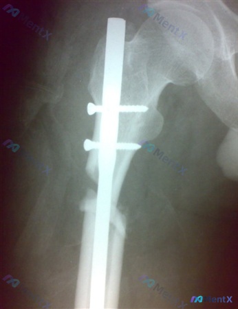 Post 1117 image 2